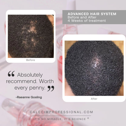 Advanced Hair System (6x5ml)