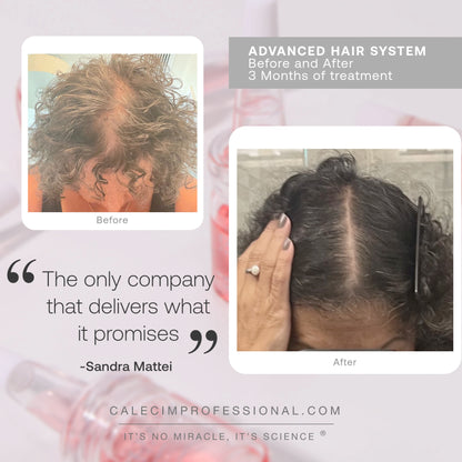 Advanced Hair System (6x5ml)